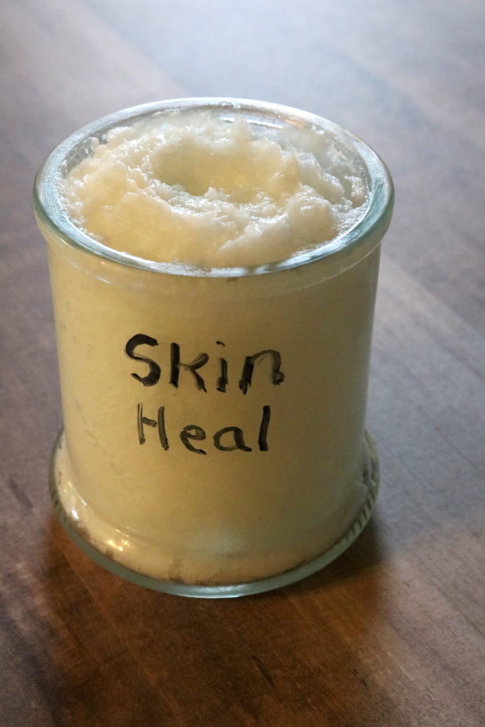 Naturally Heal Skin Conditions with Skin Heal